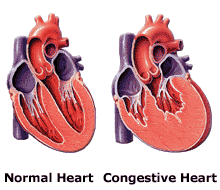 Normal Heart vs. Congestive Heart